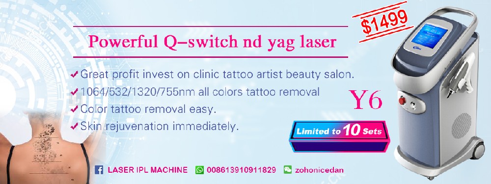 Christmas Promotion！！Powerful Q-switch nd yag laser tattoo removal machine Y6.